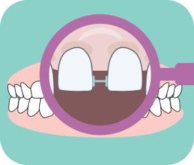 Dental development
