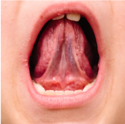 Tongue To Roof