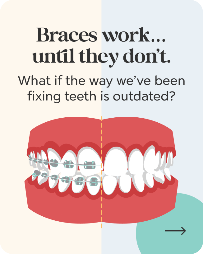 Braces work... until they don't.